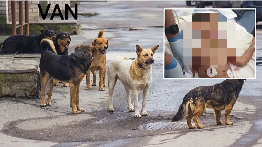 Köpeklerin saldırısında ölen çocuğun cenazesi Adli Tıp Kurumuna sevk edildi